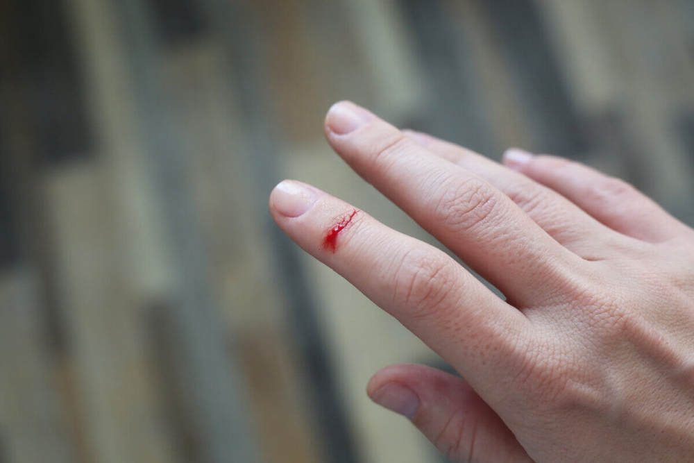 img of Cuts